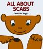 All_about_scabs