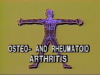 Osteoarthritis_and_Rheumatoid_Arthritis